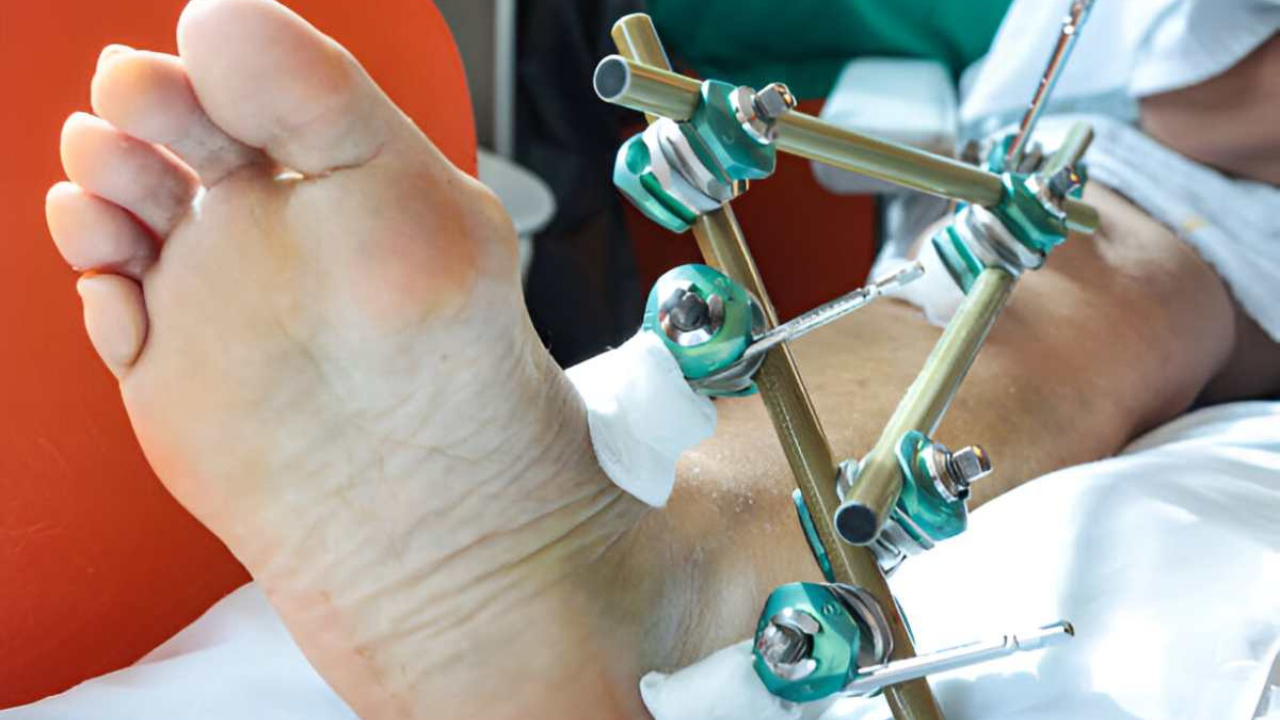 Wellhealthorganic Surgery for Wrist and Ankle Injuries: Faster, Safer Healing 1 When Is Surgery Necessary?