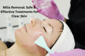 Milia Removal: Safe & Effective Treatments for Clear Skin
